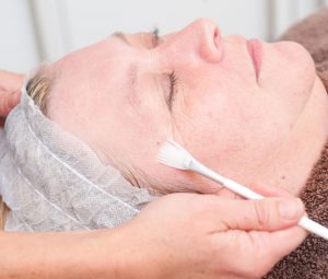 blog-winter-skin-peel-the-private-clinic