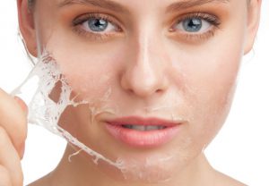 chemical peel skin take off