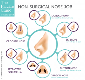 non-surgical rhinoplasty nose job procedure