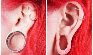 stretched ear lobe piercing before after photo