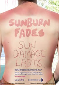 Sun Damage 