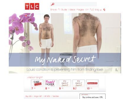 TLC's My Naked Secret - Louis and Excessive Hairiness