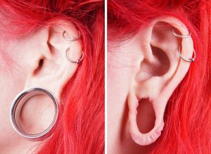 tribal earlobe treatment before after photo